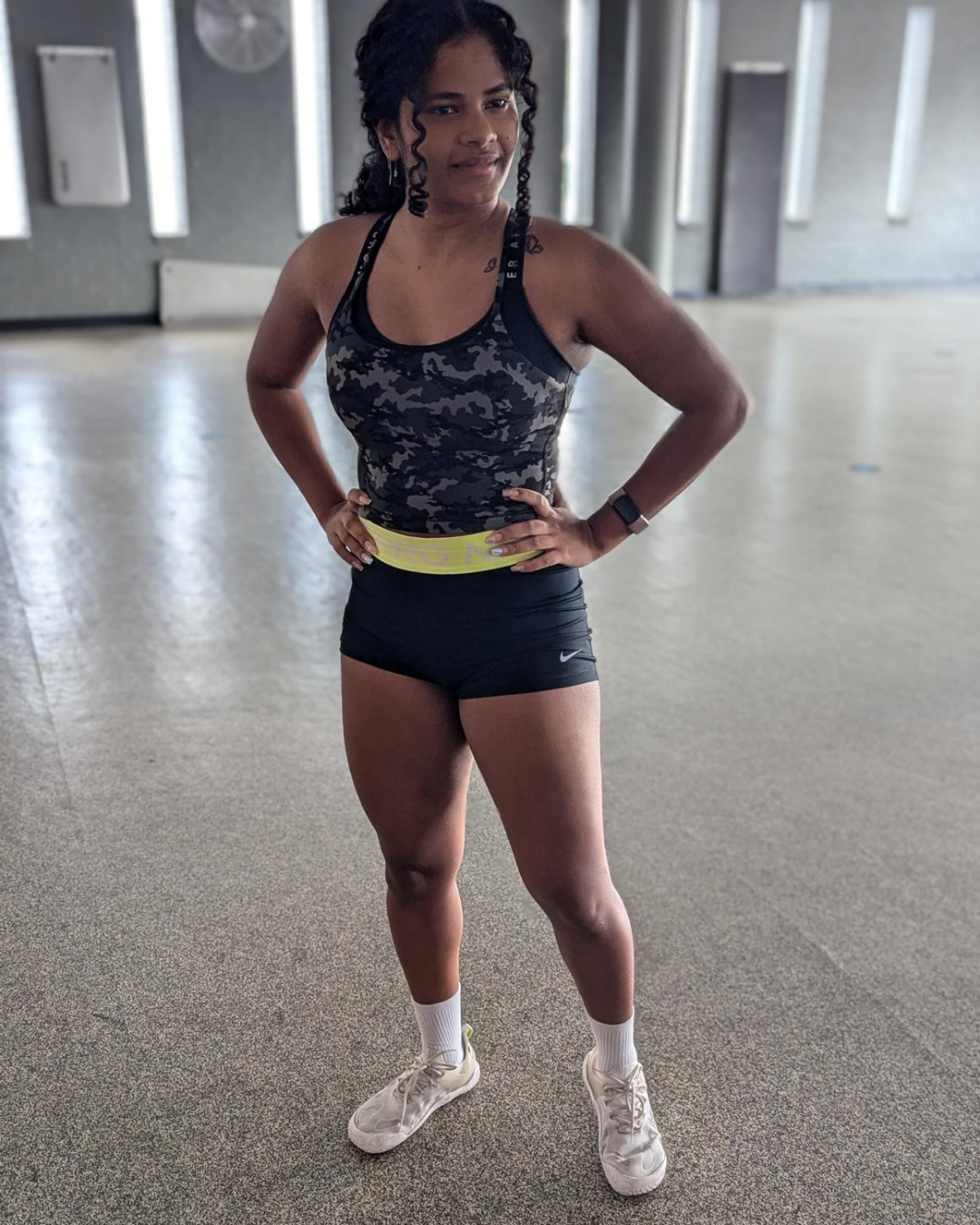 Jana's legs after rehabilitation